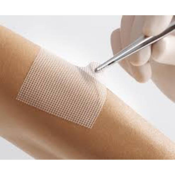 Lomatuell Pro gelvormend contactgaas - 10 x 30 cm