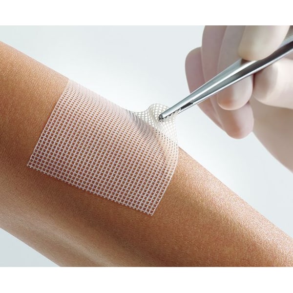 Lomatuell Pro gelvormend contactgaas - 5 x 5 cm