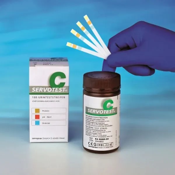Servotest urinetesten